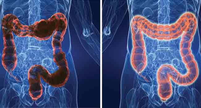 How to Naturally Cleanse Colon?